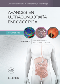 Avances en ultrasonografía endoscópica Avances en ultrasonografía endoscópica