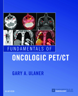 Fundamentals of Oncologic PET/CT E-Book