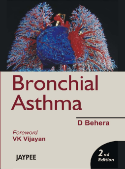 Bronchial Asthma Bronchial Asthma