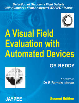 A Visual Field Evaluation with Automated Devices A Visual Field Evaluation with Automated Devices