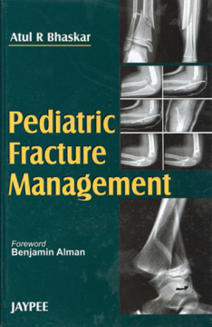 Pediatric Fracture Management Pediatric Fracture Management