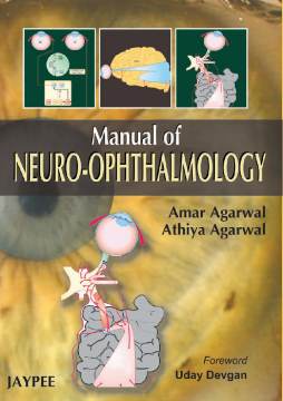 Manual of Neuro-Ophthalmology Manual of Neuro-Ophthalmology