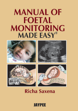 Manual of Foetal Monitoring Made Easy Manual of Foetal Monitoring Made Easy