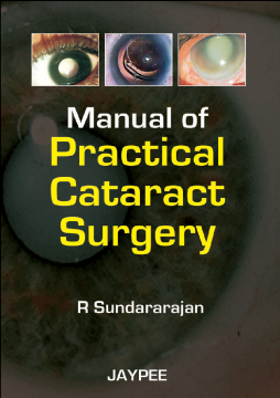 Manual of Practical Cataract Surgery Manual of Practical Cataract Surgery
