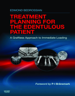 Implant Treatment Planning for the Edentulous Patient - E-Book Implant Treatment Planning for the Edentulous Patient - E-Book