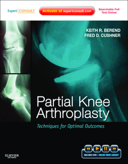 Partial Knee Arthroplasty E-Book Partial Knee Arthroplasty E-Book