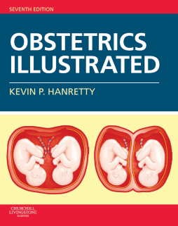 Obstetrics Illustrated E-Book Obstetrics Illustrated E-Book