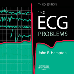 150 ECG Problems 150 ECG Problems