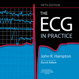 The ECG In Practice The ECG In Practice