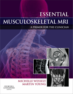 Essential Musculoskeletal MRI E-Book