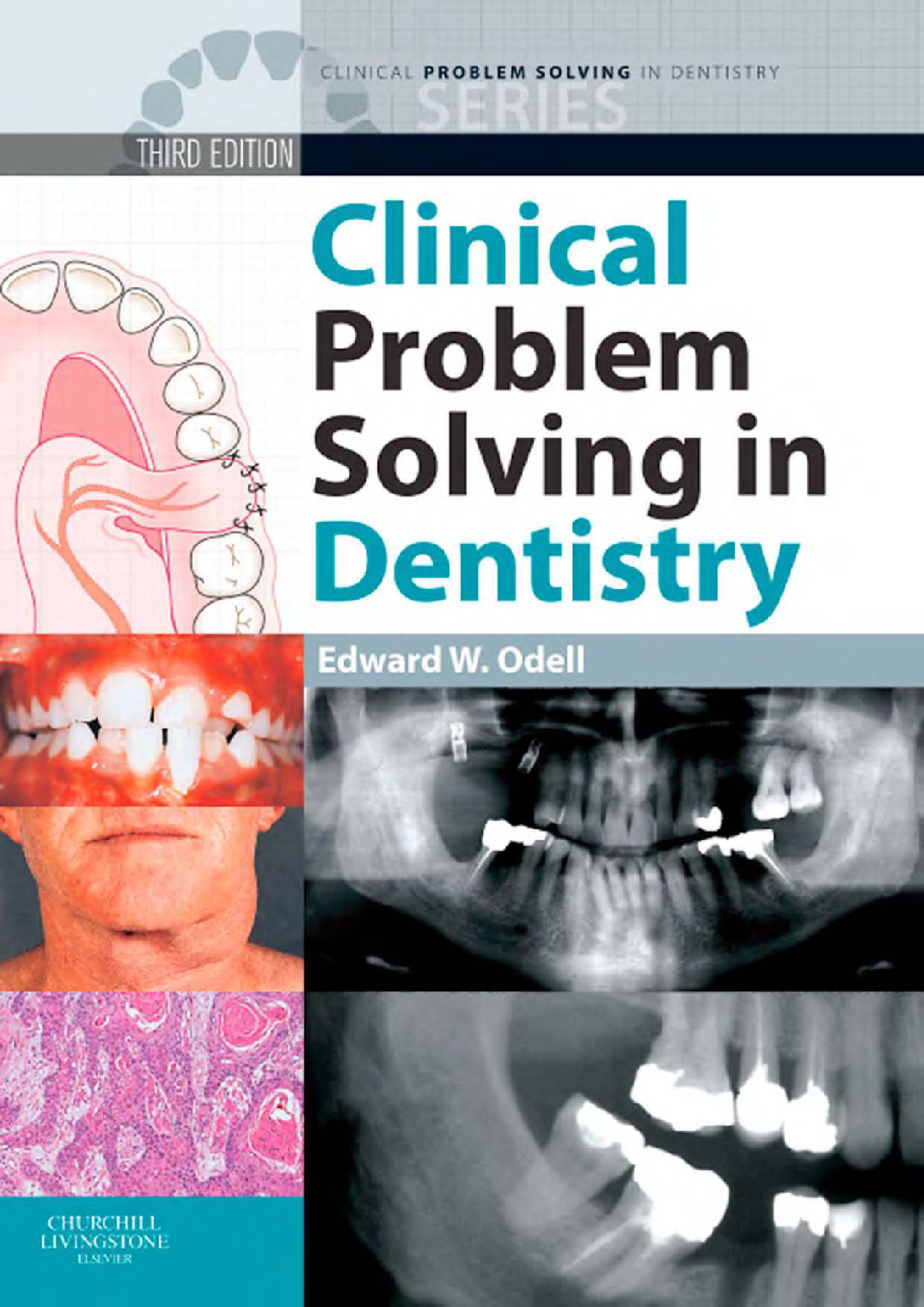 Clinical Problem Solving in Dentistry E-Book
