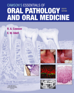 Cawson's Essentials of Oral Pathology and Oral Medicine E-Book Cawson's Essentials of Oral Pathology and Oral Medicine E-Book