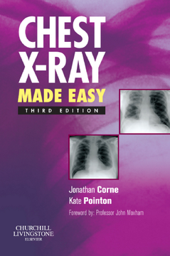 Chest X-Ray Made Easy E-Book