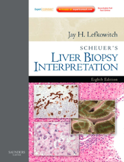 SPEC -Scheuer's Liver Biopsy Interpretatiok E-Book 12 Month Subscription