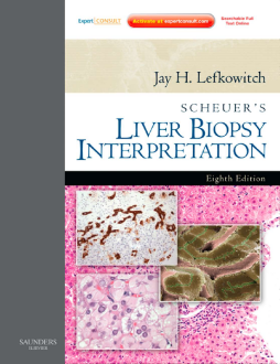 SPEC -Scheuer's Liver Biopsy Interpretatiok E-Book 12 Month Subscription SPEC -Scheuer's Liver Biopsy Interpretatiok E-Book 12 Month Subscription