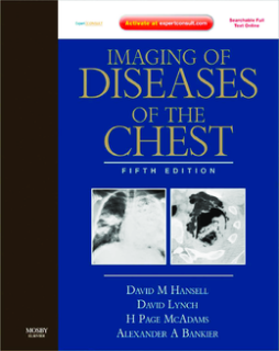 Imaging of Diseases of the Chest E-Book Imaging of Diseases of the Chest E-Book