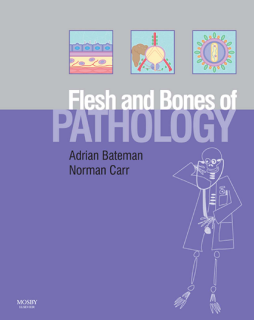 The Flesh and Bones of Pathology E-Book The Flesh and Bones of Pathology E-Book