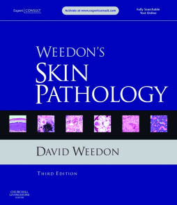 SD - Weedon's Skin Pathology E-Book SD - Weedon's Skin Pathology E-Book