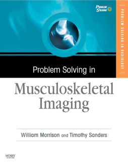 Problem Solving in Musculoskeletal Imaging E-Book Problem Solving in Musculoskeletal Imaging E-Book