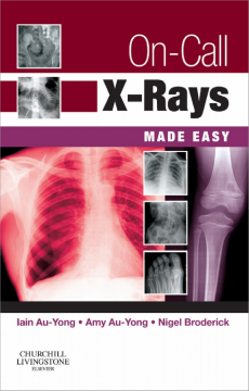 On-Call X-Rays Made Easy E-Book On-Call X-Rays Made Easy E-Book