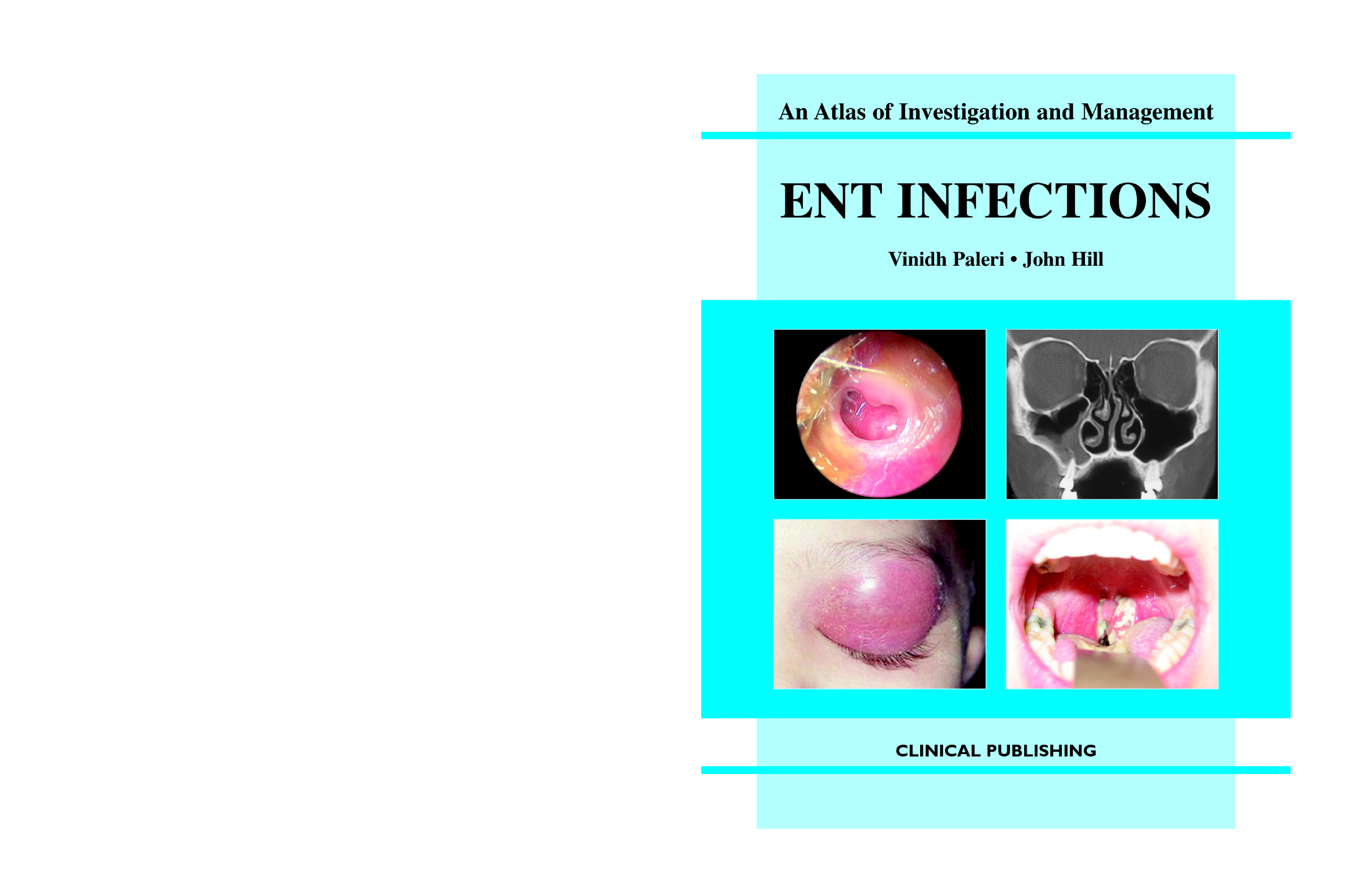 ENT Infections: an Atlas of Investigation and Management