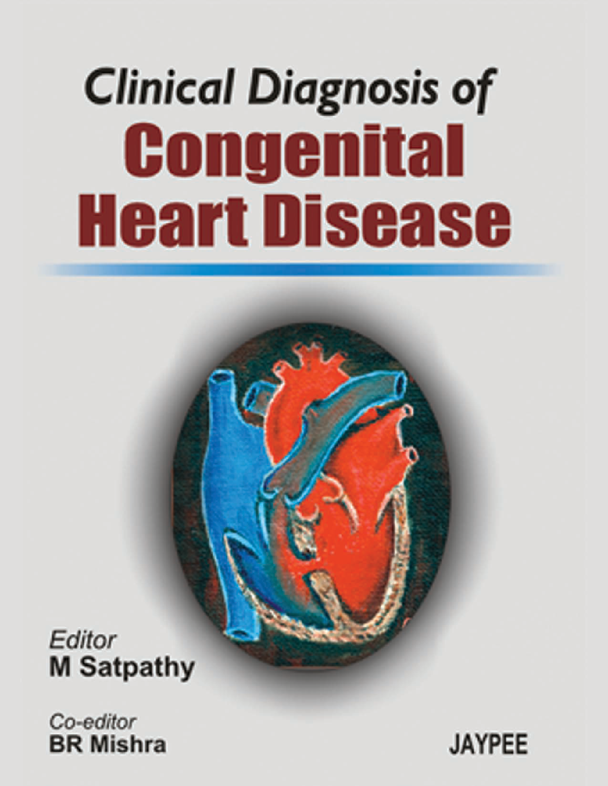 Clinical Diagnosis of Congenital Heart Disease