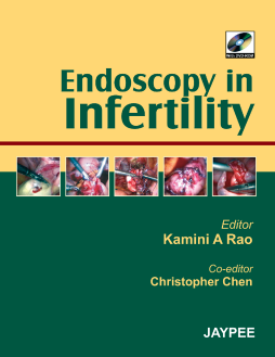 Endoscopy in Infertility Endoscopy in Infertility