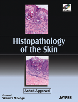 Histopathology of the Skin Histopathology of the Skin