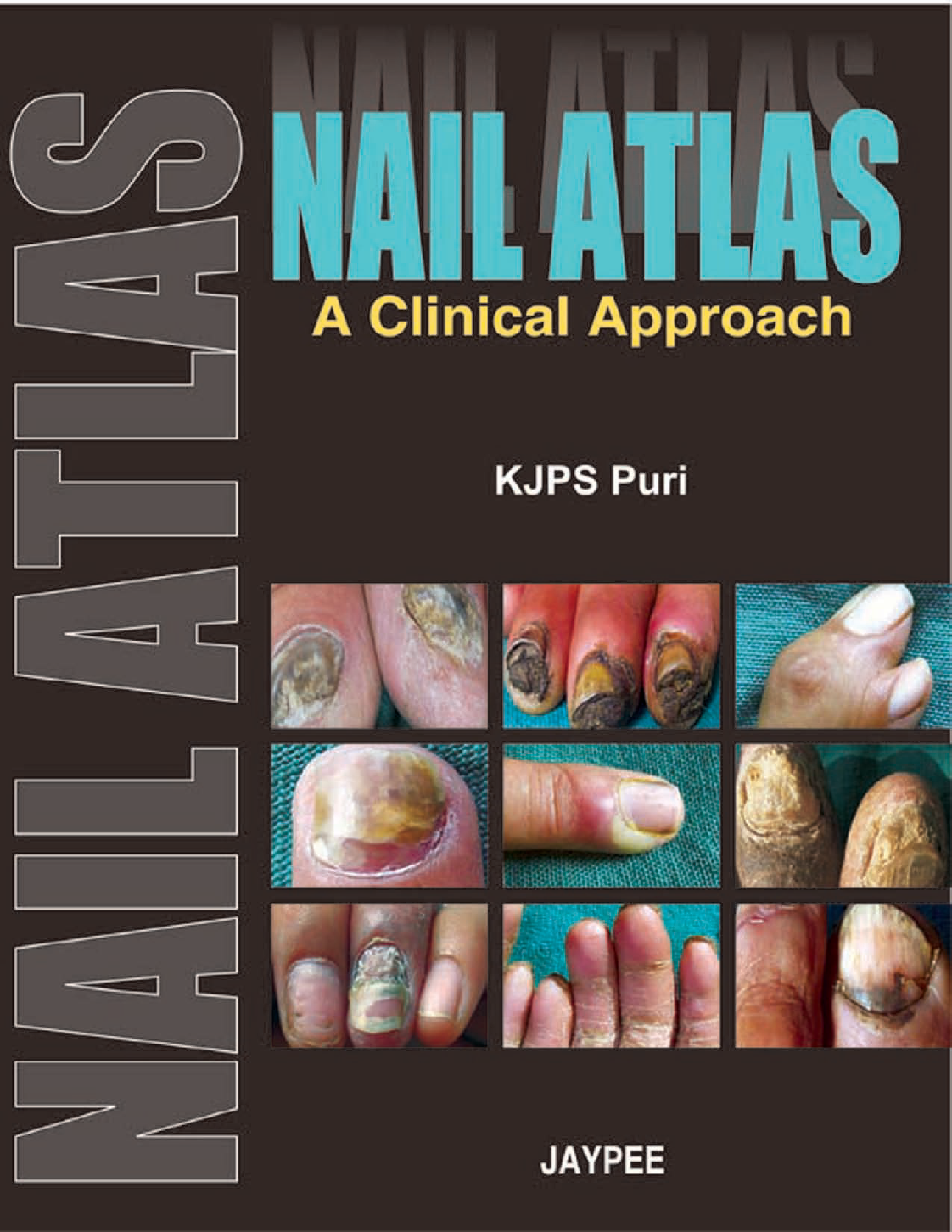 Nail Atlas