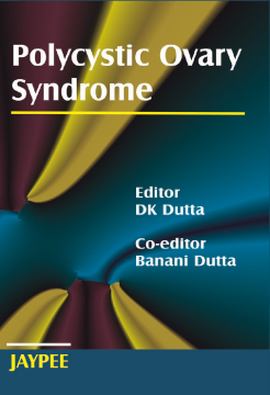 Polycystic Ovary Syndrome Polycystic Ovary Syndrome