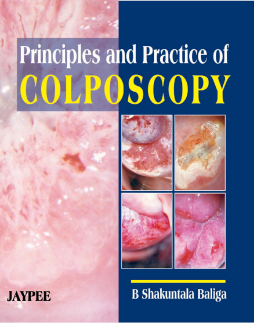 Principles & Practice of Colposcopy Principles & Practice of Colposcopy
