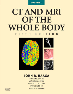 Computed Tomography & Magnetic Resonance Imaging Of The Whole Body E-Book Computed Tomography & Magnetic Resonance Imaging Of The Whole Body E-Book