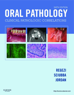 Oral Pathology - E-Book Oral Pathology - E-Book
