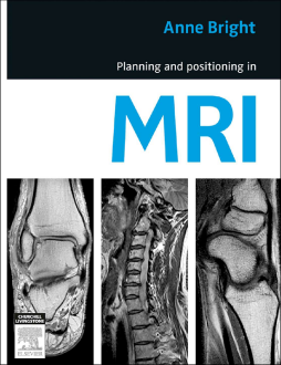 Planning and Positioning in MRI - E-Book Planning and Positioning in MRI - E-Book
