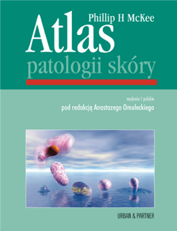 Atlas patologii skóry Atlas patologii skóry