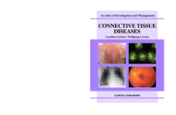 Connective Tissue Diseases: Atlas of Investigation and Management