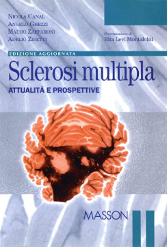 Sclerosi multipla Sclerosi multipla