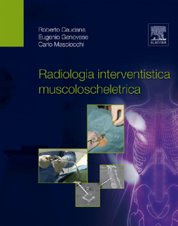 Radiologia interventistica muscoloscheletrica Radiologia interventistica muscoloscheletrica
