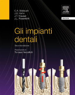 Gli impianti dentali Gli impianti dentali