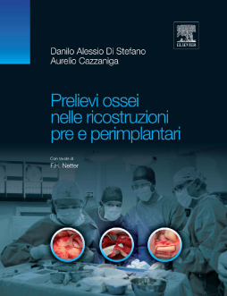 Prelievi ossei nelle ricostruzioni pre e perimplantari Prelievi ossei nelle ricostruzioni pre e perimplantari