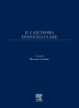 Il carcinoma epatocellulare Il carcinoma epatocellulare