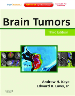 SD - Brain Tumors E-Book