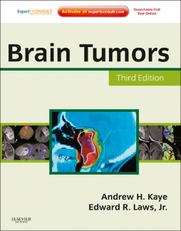 SD - Brain Tumors E-Book SD - Brain Tumors E-Book
