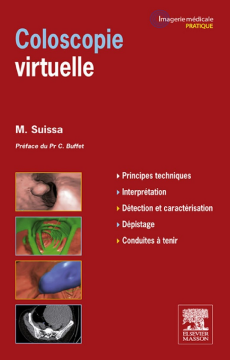 Coloscopie virtuelle Coloscopie virtuelle