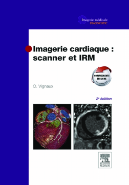 Imagerie cardiaque : scanner et IRM Imagerie cardiaque : scanner et IRM