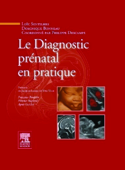 Le Diagnostic prénatal en pratique