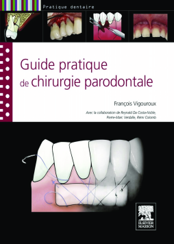 Guide pratique de chirurgie parodontale Guide pratique de chirurgie parodontale