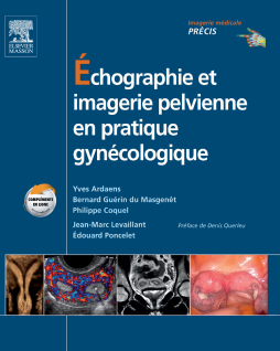 Échographie et imagerie pelvienne en pratique gynécologique Échographie et imagerie pelvienne en pratique gynécologique