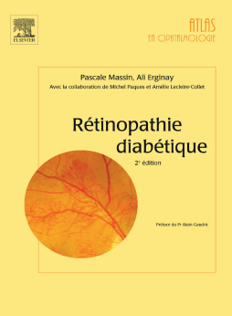 Rétinopathie diabétique Rétinopathie diabétique