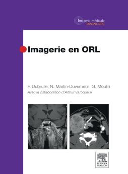 Imagerie en ORL Imagerie en ORL